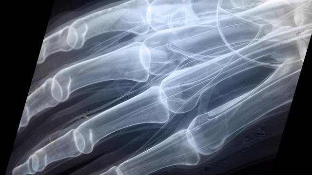 WVt2Le1nSDvUb3kauek53M